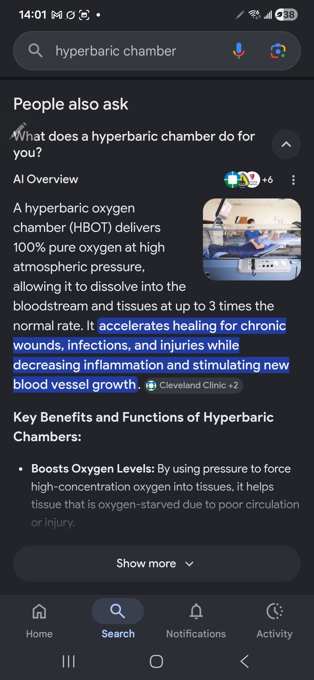 Hyperbaric Oxygen Chamber